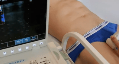 Az alsó végtagok varikoozusának diagnosztikai lehetőségei